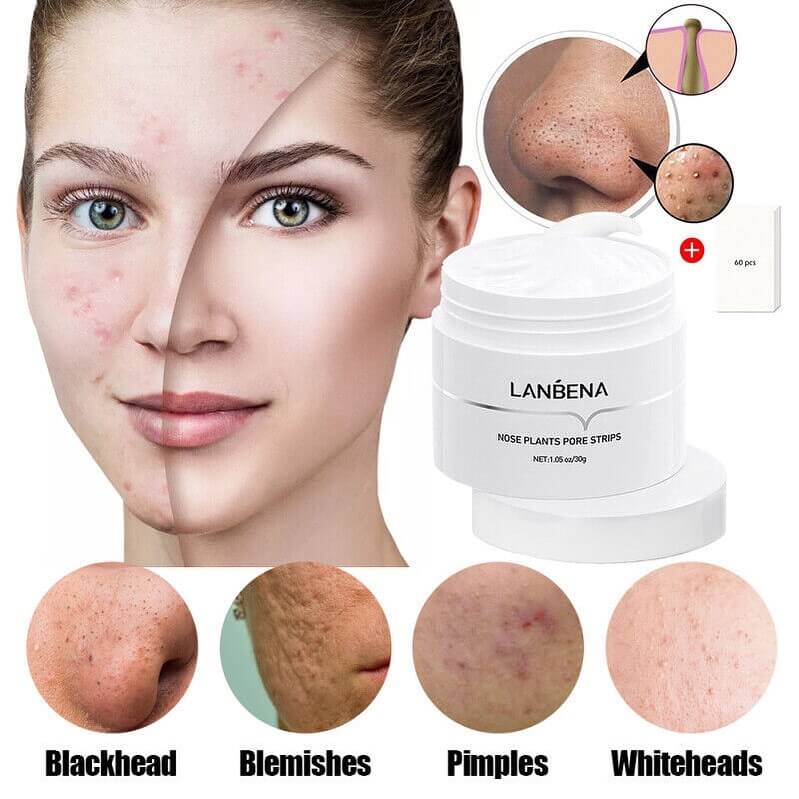 LANBENA ansiktsmask för pormaskar