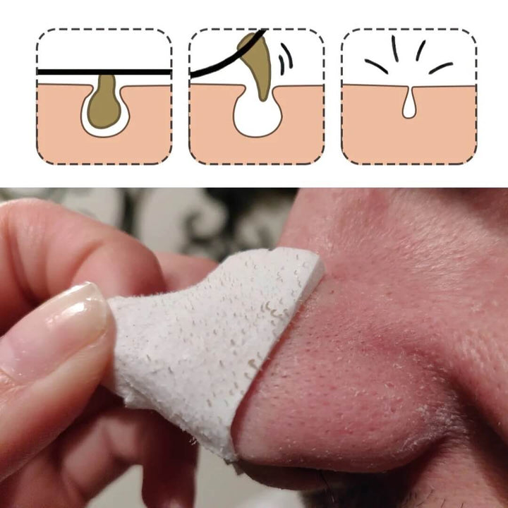 LANBENA ansiktsmask för pormaskar