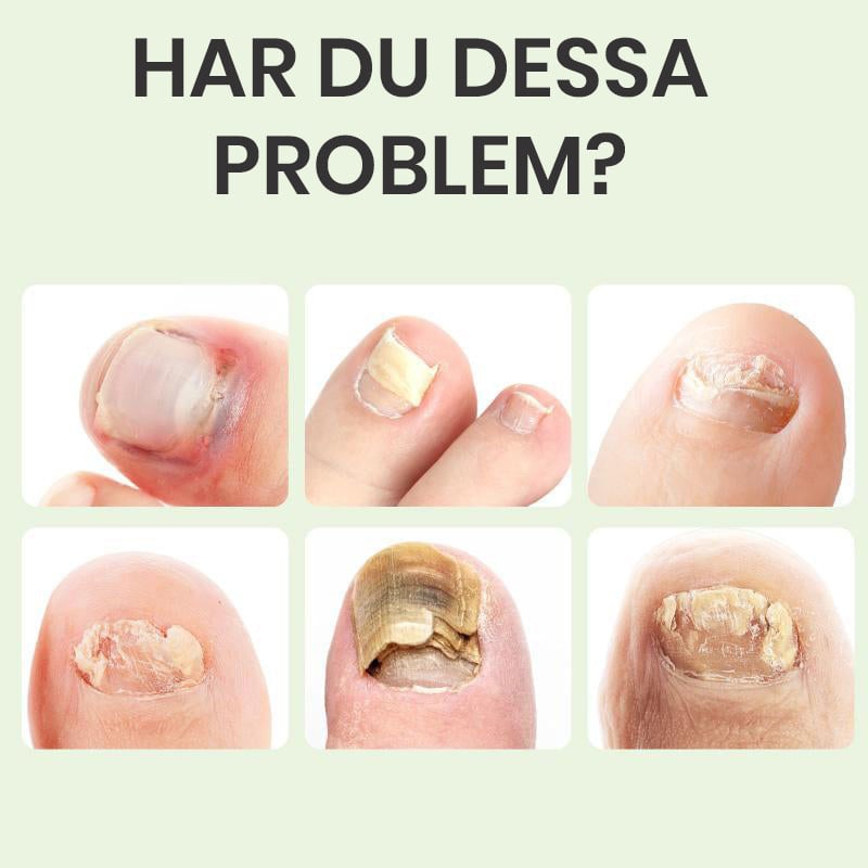 Flaska med magiska nagelreparationsdroppar för starka, friska naglar, djupverkande skönhetsprodukt.