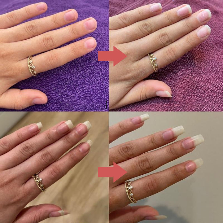 "Flaska med näringsrik nageltillväxtolja, innehållande E-vitamin och B7, omgiven av färgglada bakgrunder och dofter."