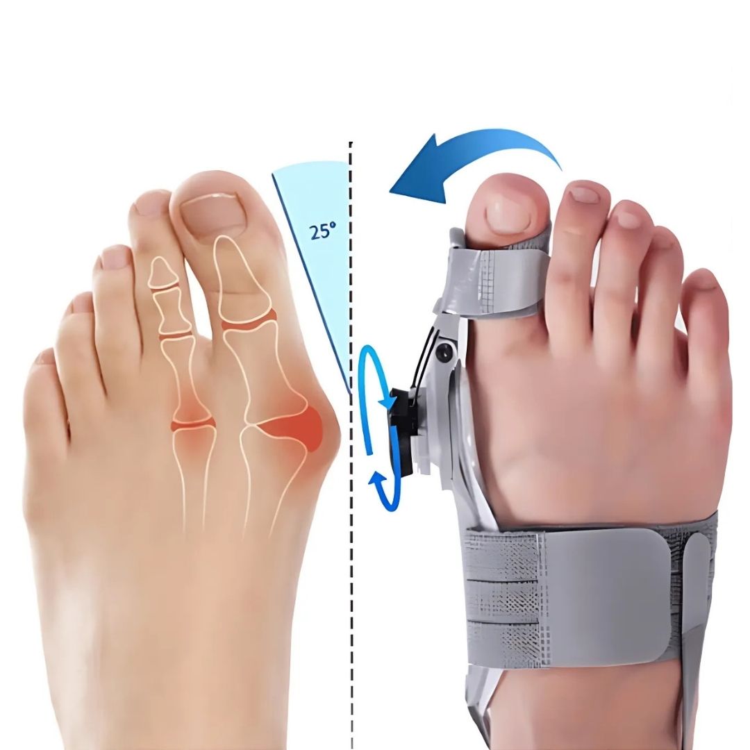 Justerbart tåstöd för hallux valgus och effektiv smärtlindring vid fotvård