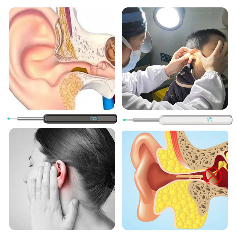 "Säker öronrengörare med spiralformat silikonhuvud och inbyggd HD-kamera för effektiv öronhygien och visuell inspektion."