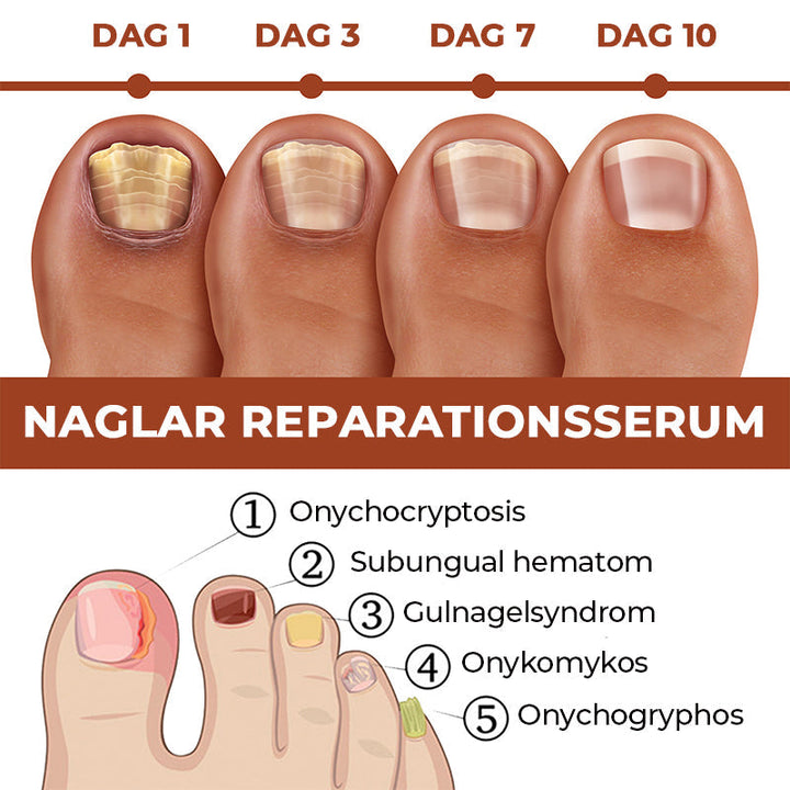 Serumflaska för nageltillväxt på vit bakgrund, snabb effekt 7 dagar, för starkare och längre naglar i 20ml förpackning.