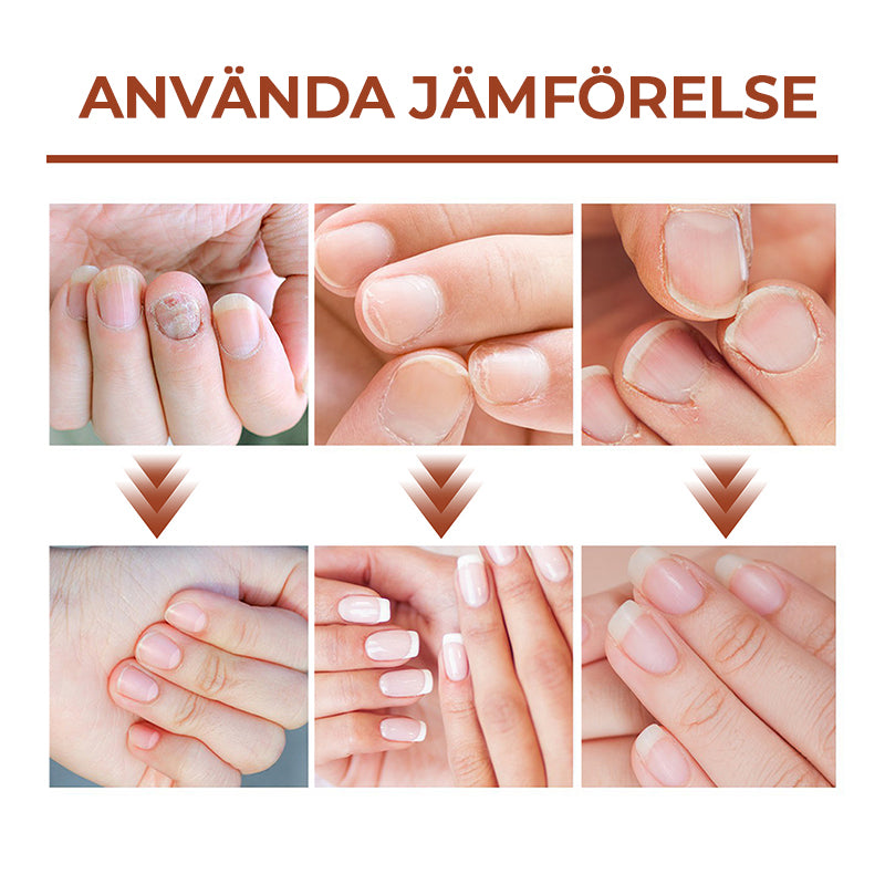 Serumflaska för nageltillväxt på vit bakgrund, snabb effekt 7 dagar, för starkare och längre naglar i 20ml förpackning.