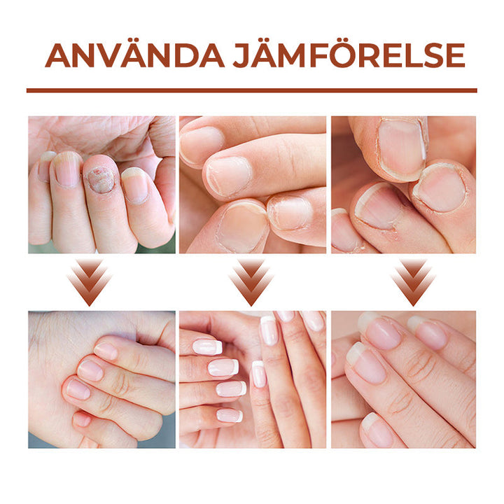 Serumflaska för nageltillväxt på vit bakgrund, snabb effekt 7 dagar, för starkare och längre naglar i 20ml förpackning.