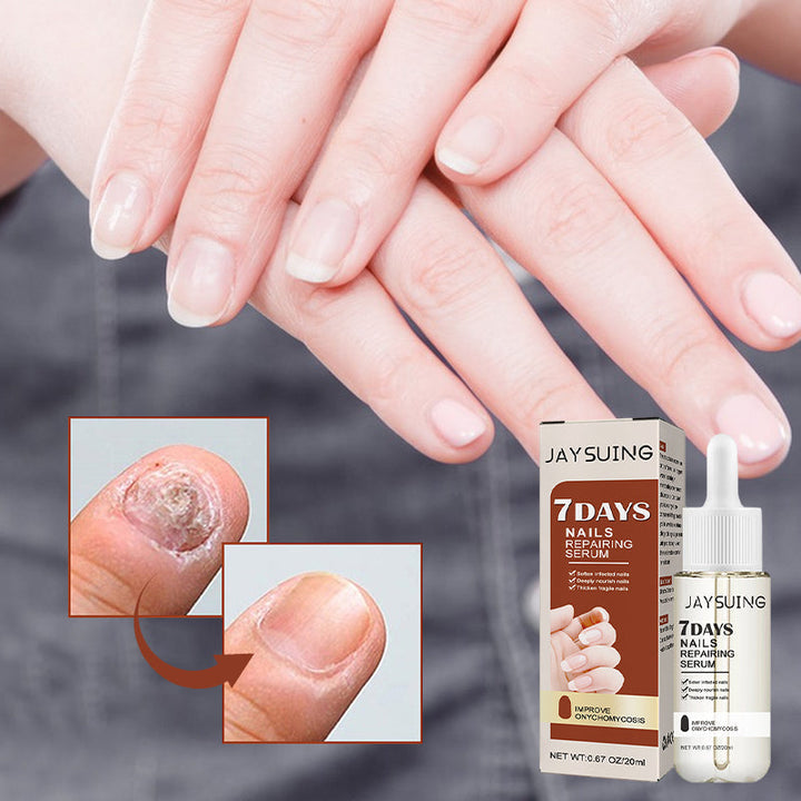 Serumflaska för nageltillväxt på vit bakgrund, snabb effekt 7 dagar, för starkare och längre naglar i 20ml förpackning.
