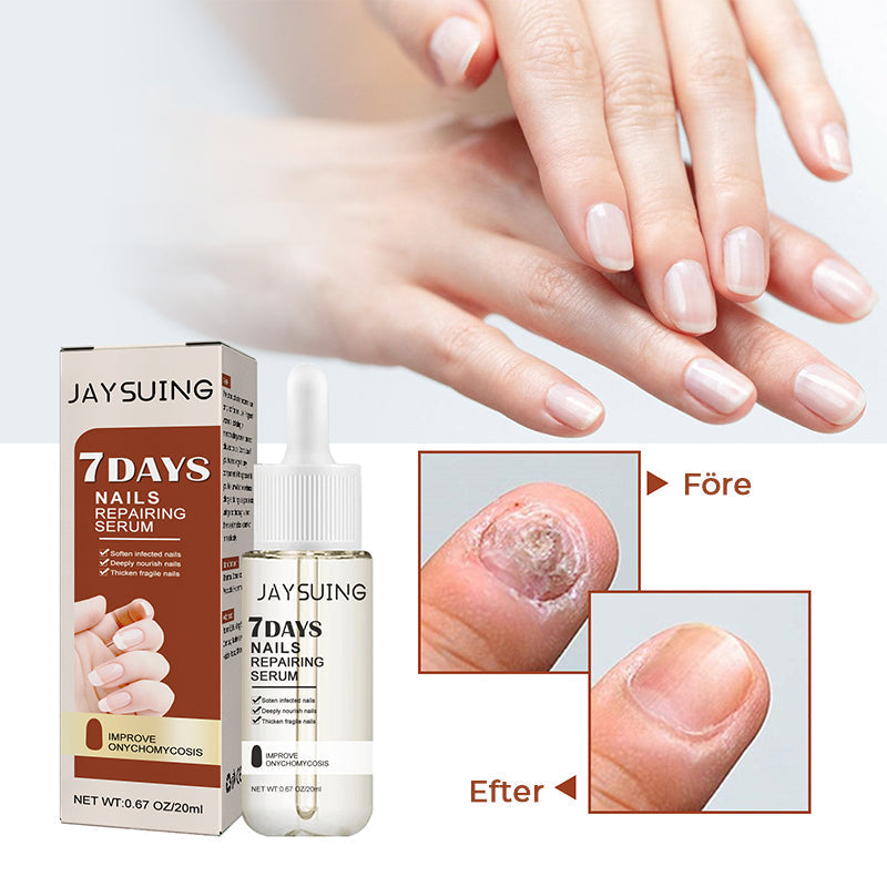 Serumflaska för nageltillväxt på vit bakgrund, snabb effekt 7 dagar, för starkare och längre naglar i 20ml förpackning.