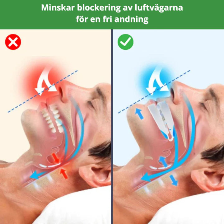 Anti-snarkskena som effektivt motverkar snarkning och bidrar till en djupare, mer vilsam sömn.