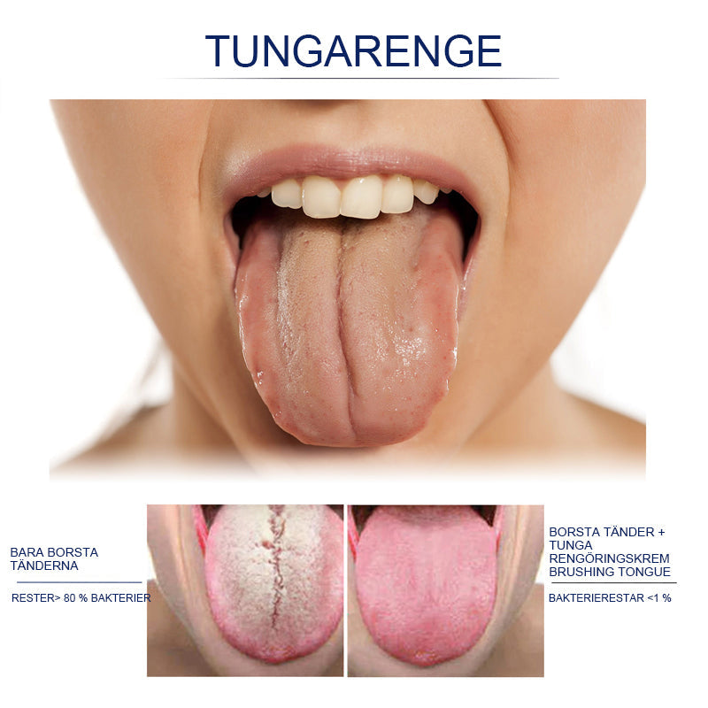 "Tungrengöringsgelset för fräsch andedräkt, inkluderar en gel i transparent tub, främjar optimal munhygien."
