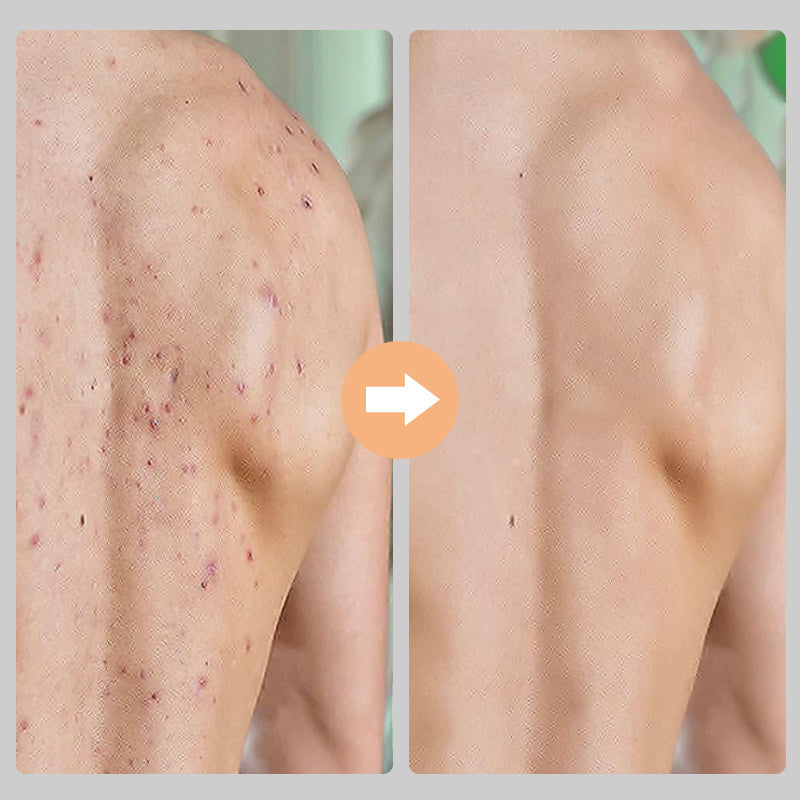 Unisex exfolierande handskar i viskos, bönbrun och lila färg, tar bort död hud för mjukare hud.