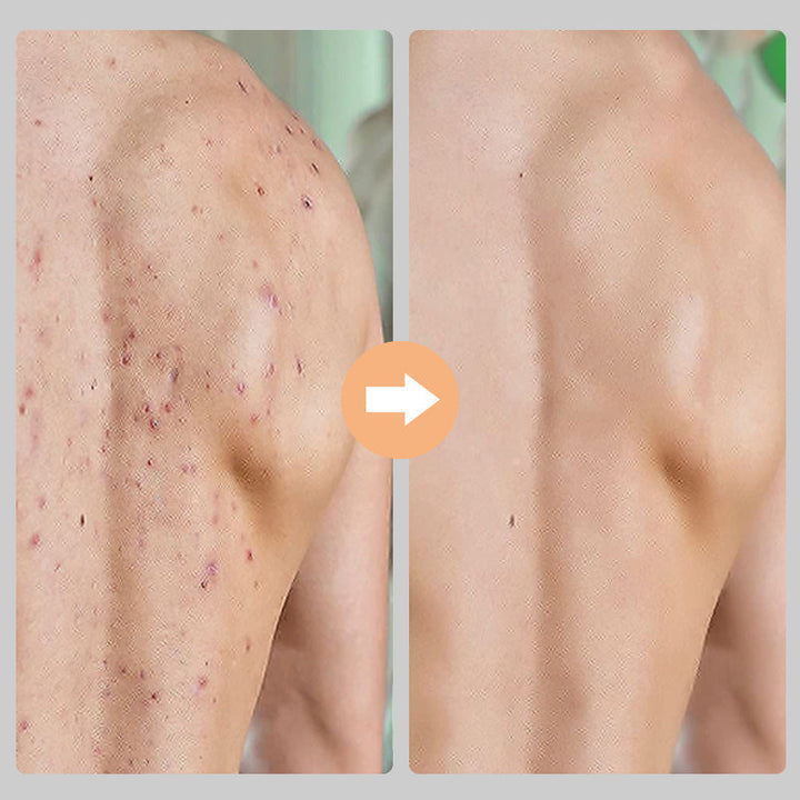 Unisex exfolierande handskar i viskos, bönbrun och lila färg, tar bort död hud för mjukare hud.
